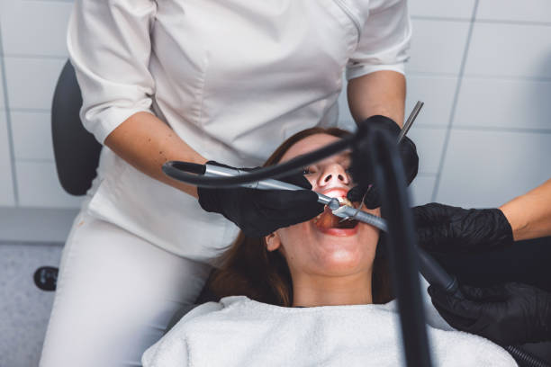 Best Knocked-Out Tooth (Avulsed Tooth) Treatment in Southeast Arcadia, FL